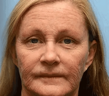 Bee Essence Skin Antibacterial Cream—used to treat a variety of skin diseases (AAD recommended)