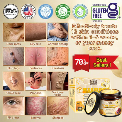 Bee Essence Skin Antibacterial Cream—used to treat a variety of skin diseases (AAD recommended)