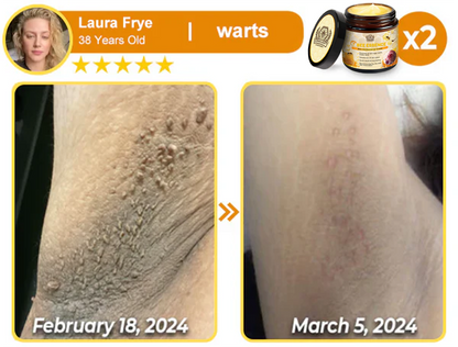 Bee Essence Skin Antibacterial Cream—used to treat a variety of skin diseases (AAD recommended)