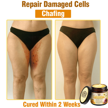 Bee Essence Skin Antibacterial Cream—used to treat a variety of skin diseases (AAD recommended)