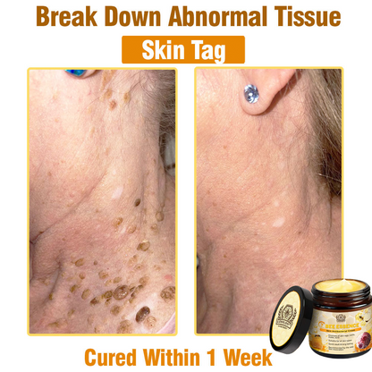 Bee Essence Skin Antibacterial Cream—used to treat a variety of skin diseases (AAD recommended)