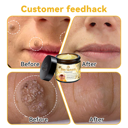 Bee Venom Skin Treatment Cream