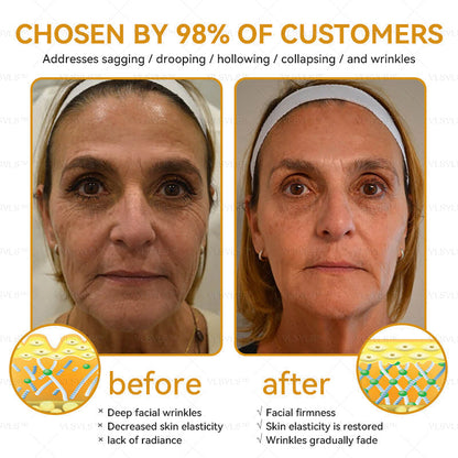 Bee Essence Skin Antibacterial Cream—used to treat a variety of skin diseases (AAD recommended)