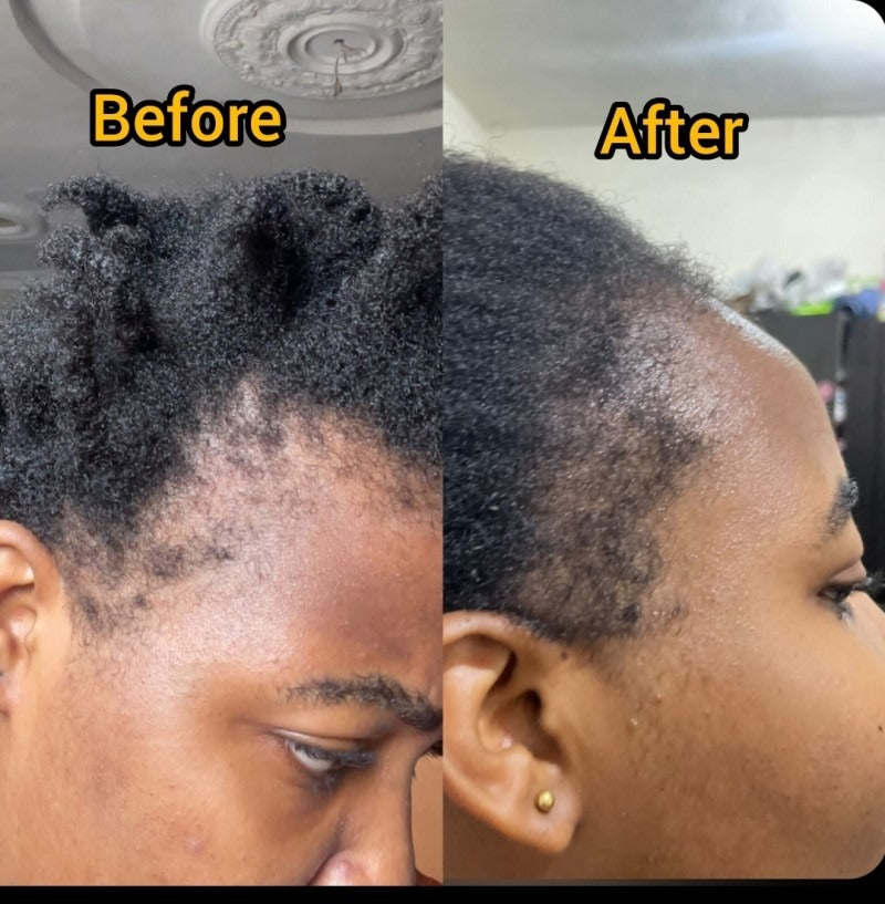 Batana Natural Hair Growth Oil